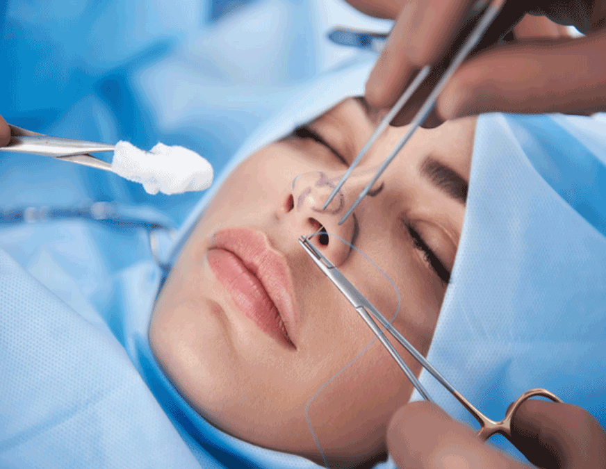 Chirurgie esthétique